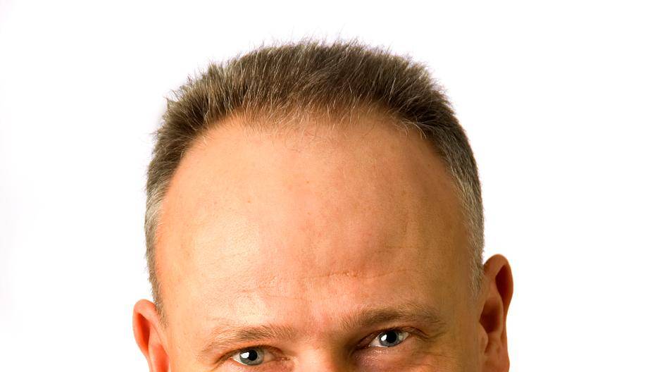 Hartmut...